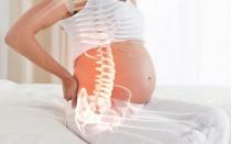 Болить спина при вагітності: причини та лікування