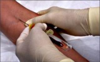 Wo und wie wird ein HIV-Test durchgeführt: Eine Beschreibung des Verfahrens und die Entschlüsselung der Ergebnisse. Ein Bluttest auf HIV wird anhand des Herzens durchgeführt.
