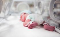 Wie behandelt man Staphylokokken bei Neugeborenen?