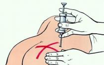 Diclofenac injections - instructions for the drug, price, analogues and instructions about stagnation Diclofenac injections are fun or pain-free